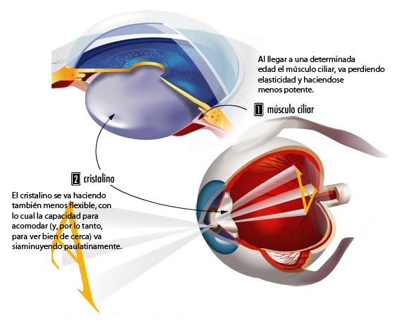 Una Enfermedad Ocular